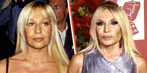 donatella versace met 1992|donatella versace before surgery.